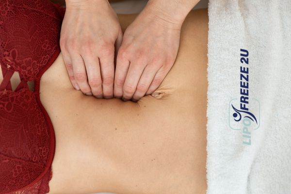 diastasis recti treatment Camberley