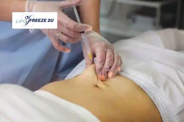 How Does Aqualyx Fat Dissolving Injection Work to Break Down Fat Camberley?