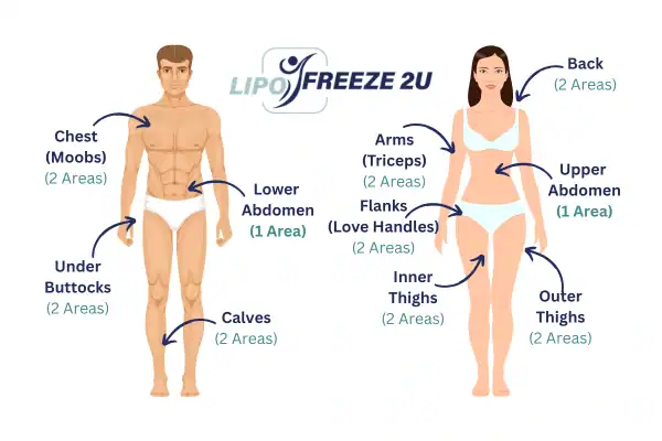 Areas you can have fat freezing treatment Camberley
