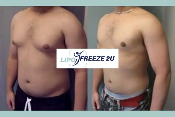How Long Does It Take to See Results Camberley?