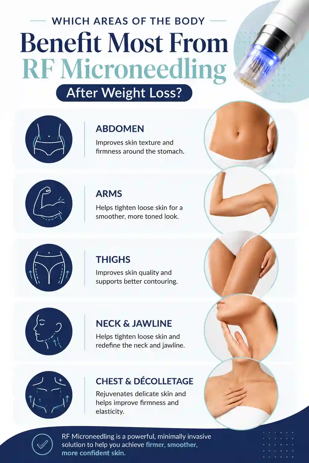 Which Areas of the Body Benefit Most From RF Microneedling After Weight Loss Camberley
